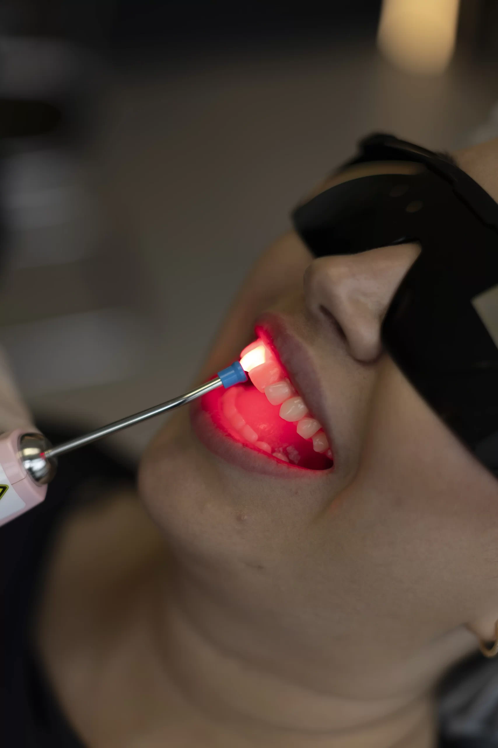 Na clínica Eco Odontologia, uma dentista especializada aplica a tecnologia de laserterapia para tratar inflamações e promover a cicatrização acelerada nos tecidos bucais de uma paciente, que utiliza óculos de proteção específicos para o procedimento. A imagem destaca o uso de recursos terapêuticos modernos, seguros e não invasivos no Eco Medical Center, em Curitiba, evidenciando como o laser auxilia no alívio da dor e na regeneração celular de forma rápida e confortável. O foco na precisão tecnológica e no bem-estar reforça o compromisso da clínica em oferecer tratamentos de vanguarda que reduzem o desconforto pós-operatório e garantem uma recuperação eficiente para pacientes de todas as idades.